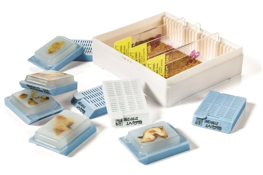 Asterand-ffpe-slide-box-1000
