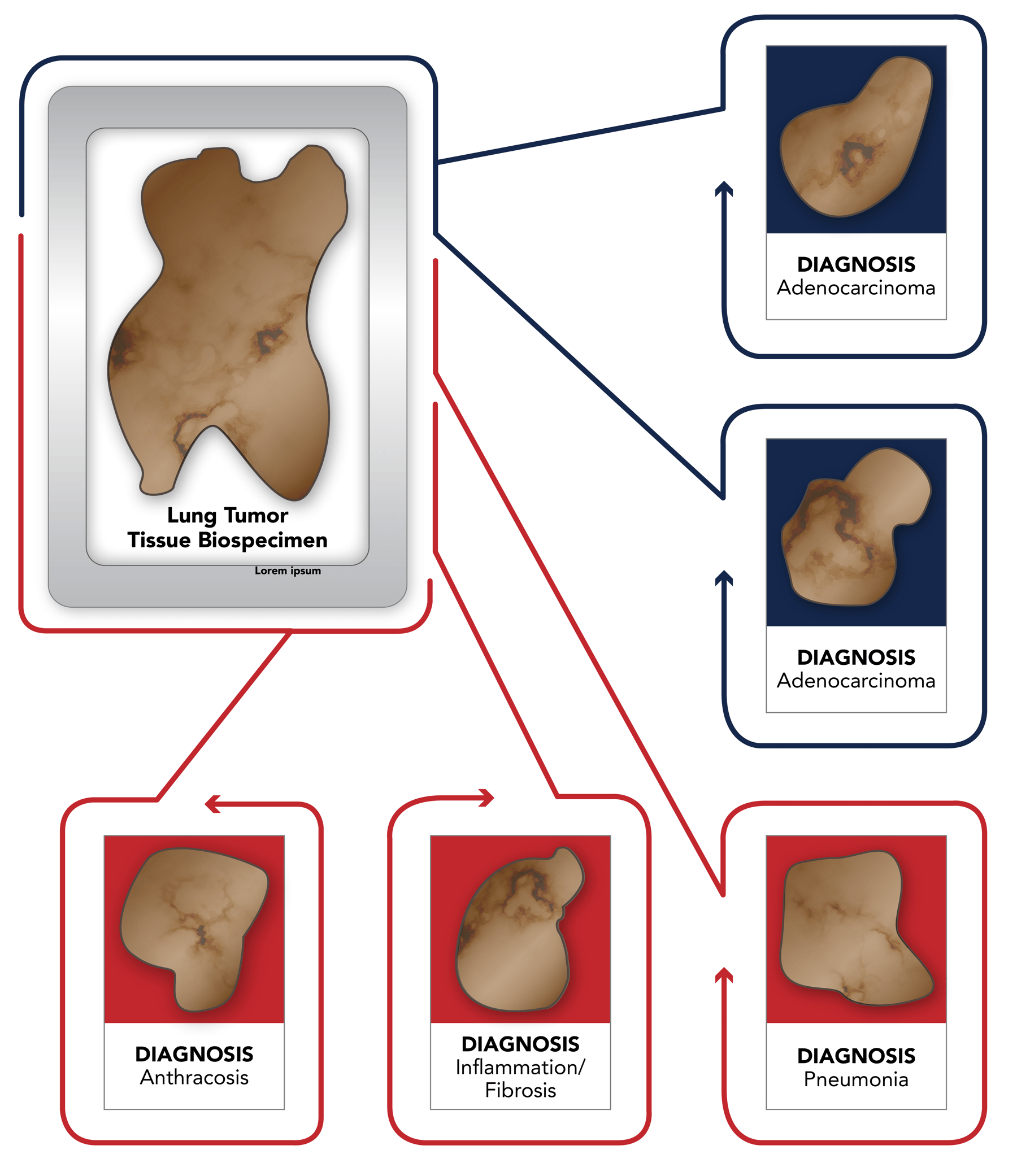 Why You Need Your Tissue Specimens Boardcertified Pathologist Reviewed