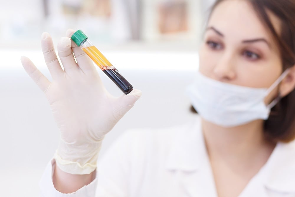 what really is a buffy coat?